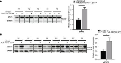 FUS-DDIT3 Fusion Oncoprotein Expression Affects JAK-STAT Signaling in Myxoid Liposarcoma